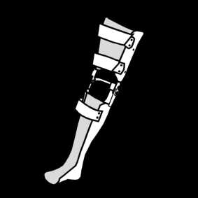 prosthetic leg